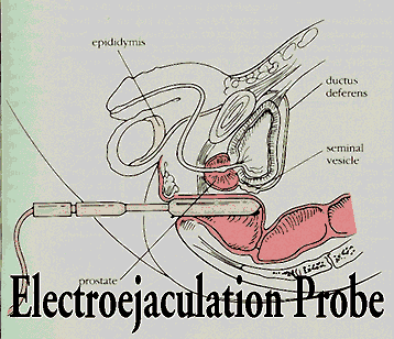 best of Ejaculation electric
