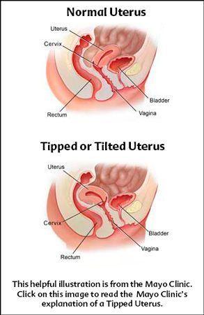 best of Info helpful positions orgasm uterus Tilted