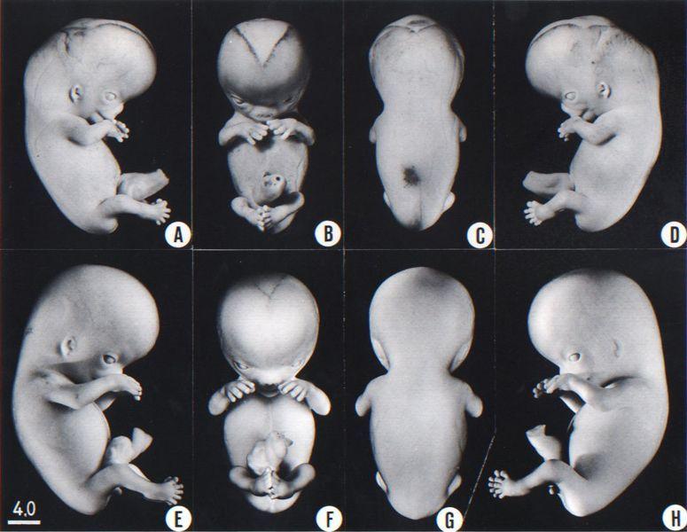 best of Human embryos Mature