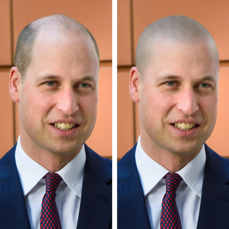 Shaved head before and after