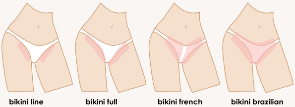 Frankenstein reccomend Female bikini wax