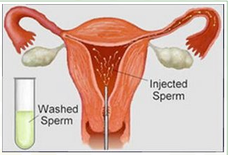 Sperm into vagina