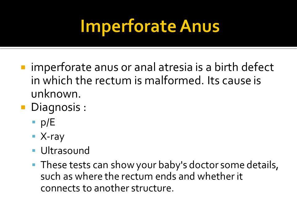 Tator T. reccomend Etiology of imperforate anus