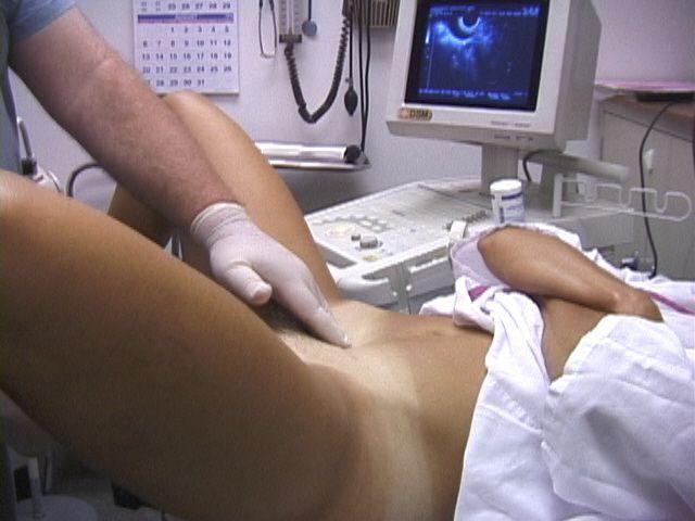 Examination of a vagina video