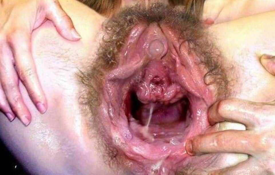 Large vagina hole