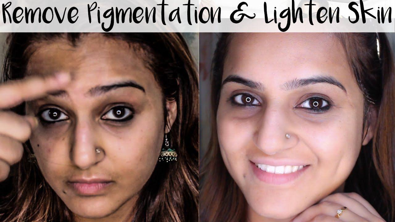 best of Skin Discoloration facial