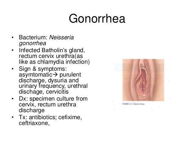 Goldfinger reccomend Gonorrhea pictures vagina