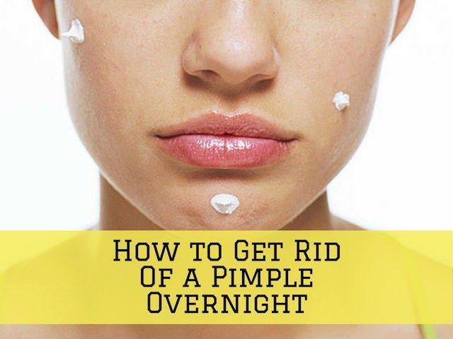 Emerald reccomend Fastest Way To Get Rid Of Zits Overnight Pron Pictures 2018