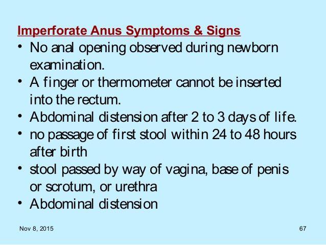 Baker reccomend Etiology of imperforate anus
