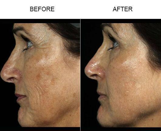Clinic reccomend Facial rejuvenation treatments orlando