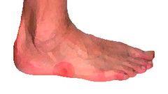 best of Bottom lateral foot Pain in