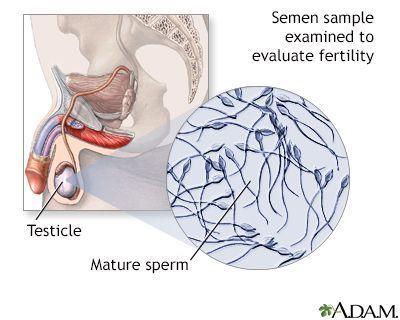 Effect of allergies on sperm count