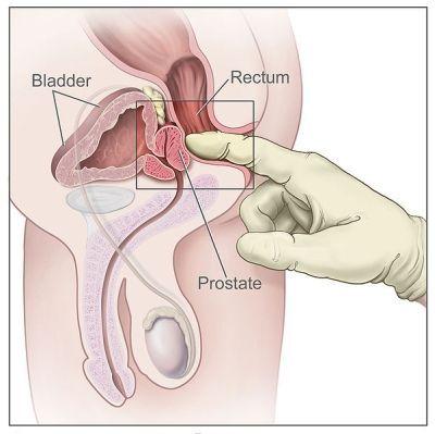 best of Finger Prostate orgasm