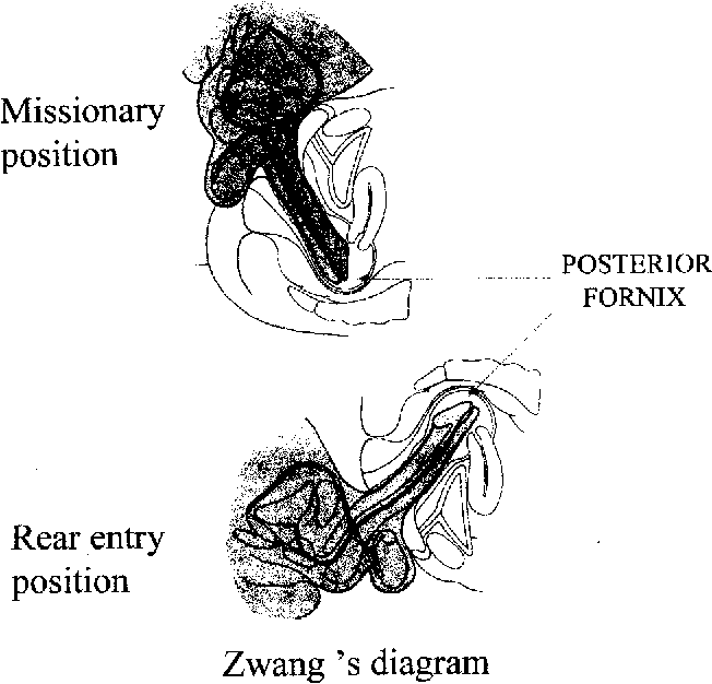 Sex position imaging