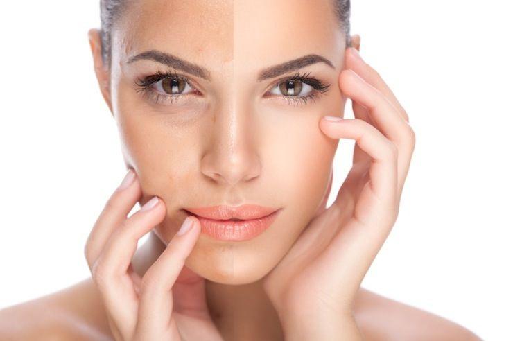 best of For pigmentation Treatment facial